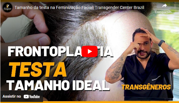 Tamanho da testa na Feminização Facial